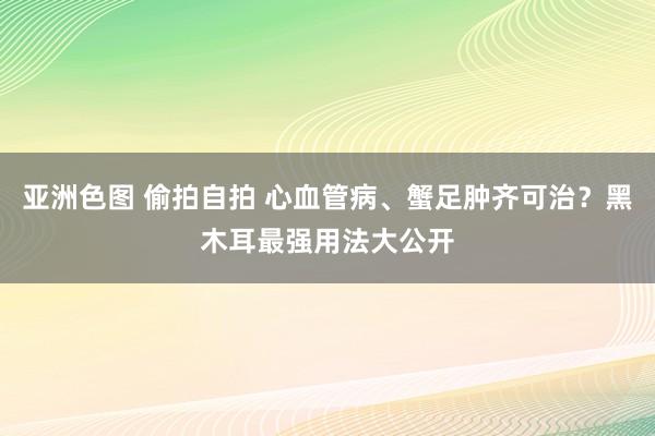 亚洲色图 偷拍自拍 心血管病、蟹足肿齐可治？黑木耳最强用法大公开